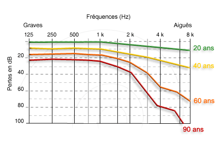 audiogramme schéma d'audiogramme